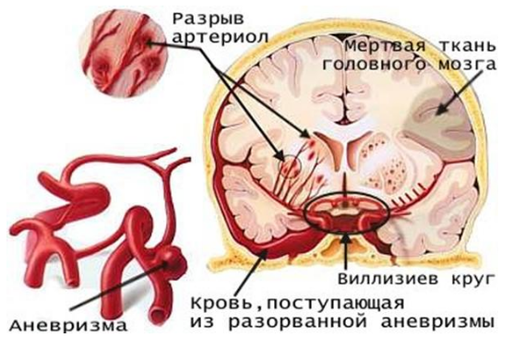 Конкурсы - Работа на конкурс от Girls only. Санталятор