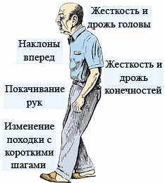 Обо всем - Эпилепсия и видеоигры